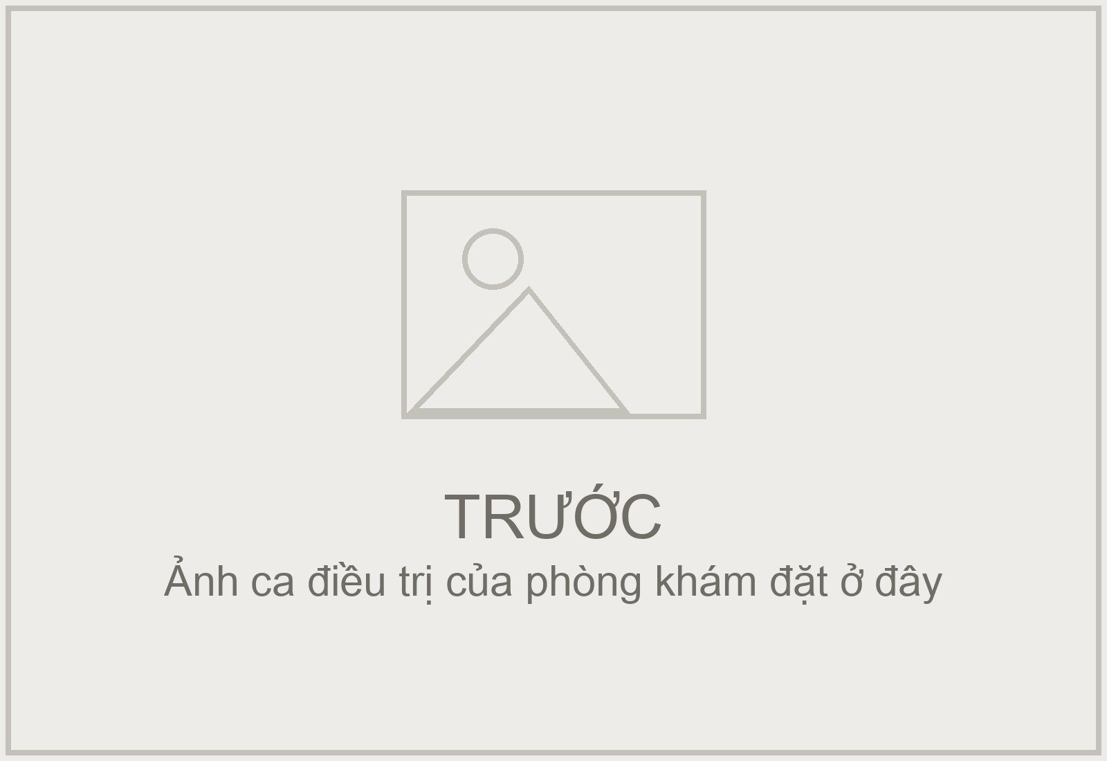 Trước — Trám hai răng cửa sâu mặt ngoài